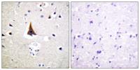 Vav2 Polyclonal Antibody