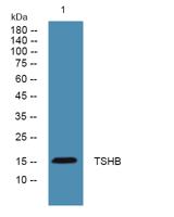 TSHB Polyclonal Antibody