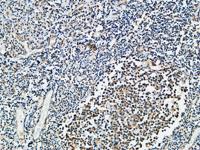 VDR Polyclonal Antibody