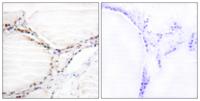 VDR Polyclonal Antibody