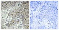 TTF-I Polyclonal Antibody