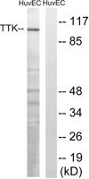 TTK Polyclonal Antibody