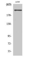 T-type Ca++ CP α1H Polyclonal Antibody