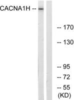 T-type Ca++ CP α1H Polyclonal Antibody