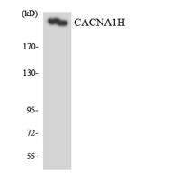 T-type Ca++ CP α1H Polyclonal Antibody