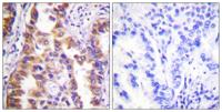 Tuberin Polyclonal Antibody