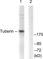 Tuberin Polyclonal Antibody