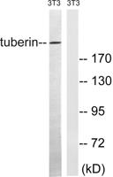 Tuberin Polyclonal Antibody