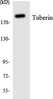 Tuberin Polyclonal Antibody