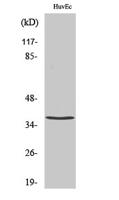 TNF-IP 1 Polyclonal Antibody