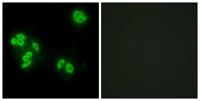 TNF-IP 8 Polyclonal Antibody