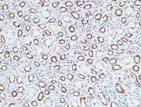 TNF-R1 Polyclonal Antibody