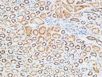 TNF-R1 Polyclonal Antibody