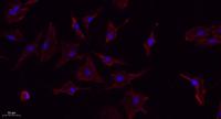 TNF-α Polyclonal Antibody