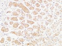 TNF-α Polyclonal Antibody