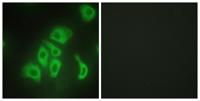 TNF-α Polyclonal Antibody