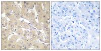 TNFα-IP 2 Polyclonal Antibody