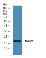 TNNC2 Polyclonal Antibody