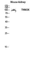 TNNI3K Polyclonal Antibody