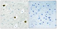 TPD52 Polyclonal Antibody