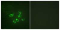 TPH1 Polyclonal Antibody