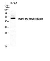 TPH1 Polyclonal Antibody