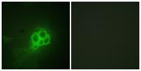 TPH1 Polyclonal Antibody