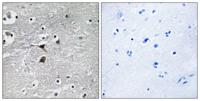 TPH1 Polyclonal Antibody