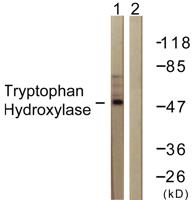 TPH1 Polyclonal Antibody