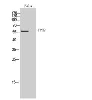 TPH2 Polyclonal Antibody