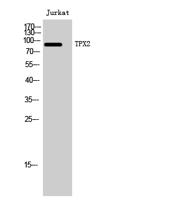 TPX2 Polyclonal Antibody