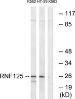 TRAC-1 Polyclonal Antibody