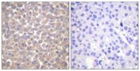 TRADD Polyclonal Antibody