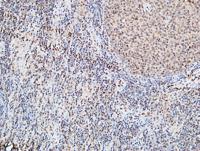 FOXP1 Polyclonal Antibody