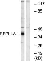 RFPL4A Polyclonal Antibody