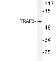 TRAF6 Polyclonal Antibody