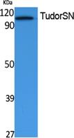 TudorSN Polyclonal Antibody