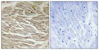 TUSC2 Polyclonal Antibody