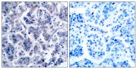 Tyk 2 Polyclonal Antibody