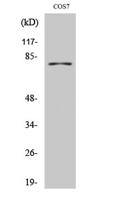 TYR Polyclonal Antibody