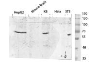 TYR Polyclonal Antibody