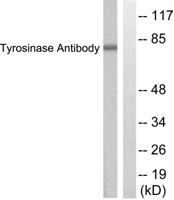 TYR Polyclonal Antibody