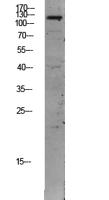 TIE2 Polyclonal Antibody