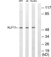 TIEG2 Polyclonal Antibody