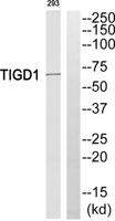 TIGD1 Polyclonal Antibody