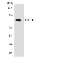 TIGD1 Polyclonal Antibody