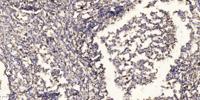 TIGD1 Polyclonal Antibody