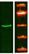 TIGD2 Polyclonal Antibody