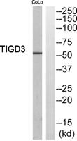 TIGD3 Polyclonal Antibody