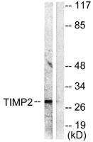 TIMP-2 Polyclonal Antibody